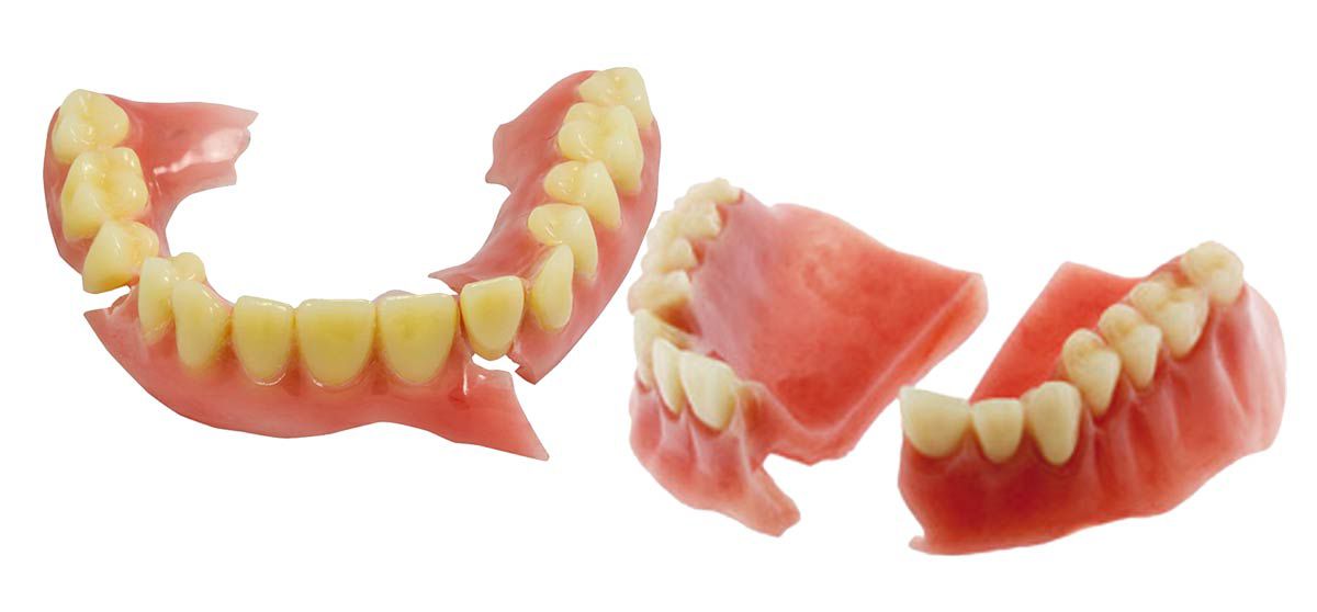Denture Repair